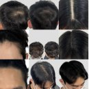 채도스칼프 이미지