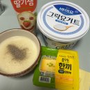 치아 교정일기 #3 매복 사랑니 3개 발치 후기 (비용, 실비 청구, 통증, 붓기)