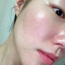 진명메디칼 | 서면피부관리 멀티 색소관리 트라이엄 후기 뷰티119