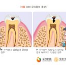 서울테라치과 이미지