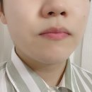크로스메드 네이버블로그