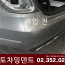 오토덴트칼라 이미지
