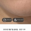 인모드fx풀페+윤곽주사 3cc+이중턱슈링크100샷 후기 이미지