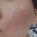 유니베라희망 | 내돈주고쓰는 유니베라 알로에스킨케어100 솔직후기💚