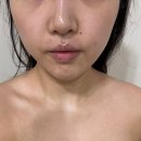 잠실중앙상가 | 잠실새내피부관리 폴라리스 에스테틱 물방울리프팅 트러블케어 후기