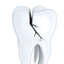 다소치과기공소 이미지