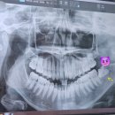 사랑니빠지는구강악안면외과치과의원 이미지