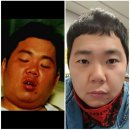 삼일키즈태권도 | MBC 다이어트코리아 체험후기~~!!