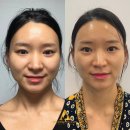 유니약국 | [공지] 피부샵 원장이 추천하는 순수비타민C앰플 / 미백화장품 유니앤코어후기