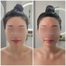 더안 | 진주웨딩관리·윤곽관리·작은얼굴관리 전문 더안뷰티 칠암점 방문후기