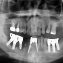 더엠디 치주과 치과의원 이미지
