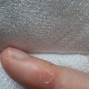 소순남피부과 치료후기와 소순남이용법