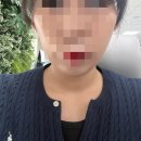 안녕토르 | 예신 필수 관리 '브이토르' 내돈내산 후기 / 고주파리프팅, 윤곽주사 추천
