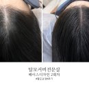 [대전/도안동] 2회차 후기, 가르마 헤어라인 고민 해결 탈모커버전문 페이스디자인