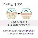 천호인셀덤