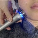 압구정피부과 비욘드의원 온다리프팅후기 | 앞볼 심부볼 탄력 고민으로 60kJ 받고 온 솔직 후기