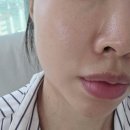 ㈜명성 | CNP 프로폴리스 레스큐 앰플 여름에 딱! 트러블 피지 케어 전문앰플 후기