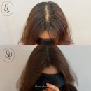 촘촘스칼프