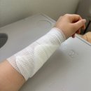 의)정우의료재단 더프라우병원 | [울산 더 프라우 병원] 수부외과 오상호 원장님 손목 결절성 근막염 수술 후기