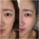 수원-0636 | 수원 영통 스킨플래닝 모데이왁싱 영통점, 피부좋아보이는 관리 추천