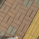 하니멍's(하니멍쓰) | 인천 복부지방흡입 골반지방이식수술 당일후기(병원,통증,멍)