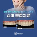 이노치과의원 | 금천구치과 잘하는곳 아름다운 미소를 되찾아드리는 앞니 심미보철 사례