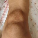 자연마디한의원 | 마디락 알아보다가 관절 통증 해결한 후기