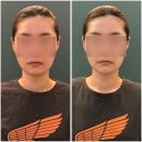 천안불당동 웨딩관리 예비신부관리로 엘마르에스테틱에서 동안작은얼굴관리 받은 후기