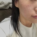 청담피부과의원 | Apr 22 • 청담피부과의원에서 처음 맞아보는 리쥬베룩 솔직후기