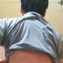 플라즈마힐링센타