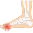 바른발가락 이미지