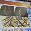 지혜의 나무 | [신당] 프리미엄 두피 마사지 ‘지혜스트리’ 후기 | 탈모관리 두피관리 잘하는 곳 추천