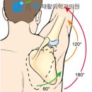 강남수재활의학과의원 | 어깨가 안 올라가면 다 오십견일까? 실패 없는 어깨 통증 치료와 오십견 완치법