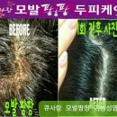 큐케어 이미지