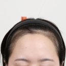 부산 맘모스헤어라인의원 이미지