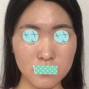 예롬성형외과 네이버블로그