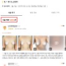 미래성형외과의원 | 가슴확대수술후기 100개를 봐도 혼란스럽다면? <20년 가슴성형 전문의 조언>