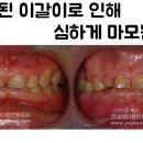금하치과 네이버블로그