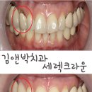 보일치과기공소 이미지