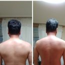 보교스킨케어