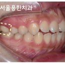 보일치과기공소 이미지