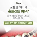 마린시티치과교정과치과의원 | 창원중동치과 치아교정 중 이가 흔들리는 거 같아요