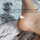 동성당약국 | [공지] [동성제약x두부누나네]절박하신 분들만 쓰세요!!유그린에프 크림