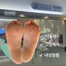 이천 문제성 발 전문#라파엘
