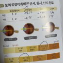라이트피아(주) - 파주시 | 라식 후기 ; 알고 있다는 착각