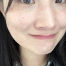 멍미살롱 | N번째 쓰는 꿀템 추천 3가지 (두피 건선 샴푸 그래믹스 • 더마소드 셀프 mts • 모델링 팩)