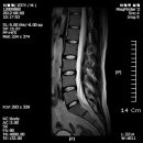 엠알아이 이미지