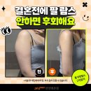 365MC의원 | 안양 365mc 예비신부다이어트 웨딩라인, 실제 후기 Before &amp; After