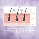 티나스칼프