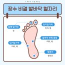 손발 마사지로 병 예방하고 고치기 이미지
